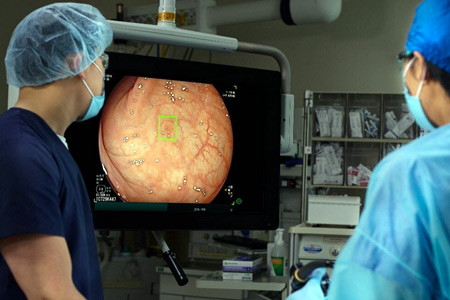 Surgeons utilize the groundbreaking GI Genius