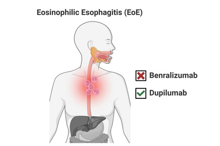 eosinophilic esophagitis (EoE) 