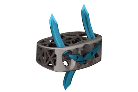 Anterior Spine Truss System