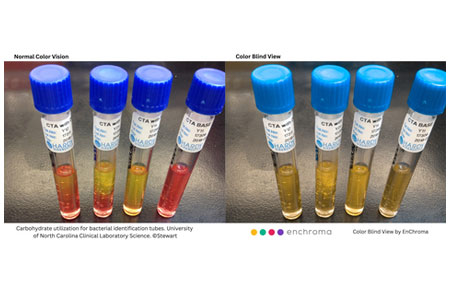 Bacterial Identification Tubes