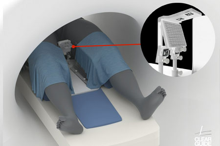 CLEAR GUIDE SCENERGY™ Device