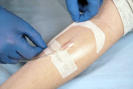 Covalon's transparent