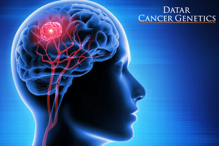  Blood Test to Help Diagnose Inaccessible Brain Tumors 