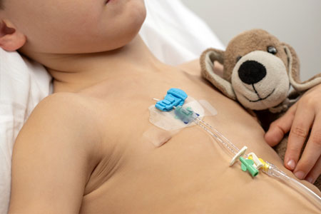 FlexGRIP catheter securement device