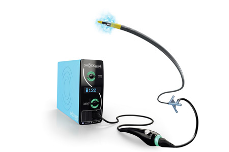 Shockwave Javelin Peripheral IVL Catheter 