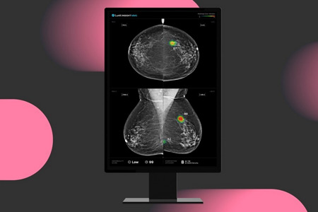 Lunit's AI-powered mammography analysis solution, Lunit INSIGHT MMG