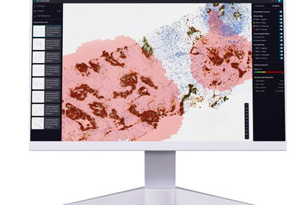 "Lunit SCOPE HER2", Lunit's 