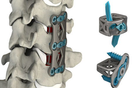 4WEB Medical Cervical Portfolio 