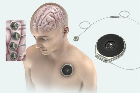  Paradromics Connexus®