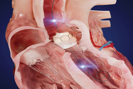 Proprietary Wireless Ecosystem