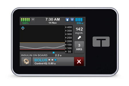  t:slim X2 insulin pump with Control-IQ+ technology